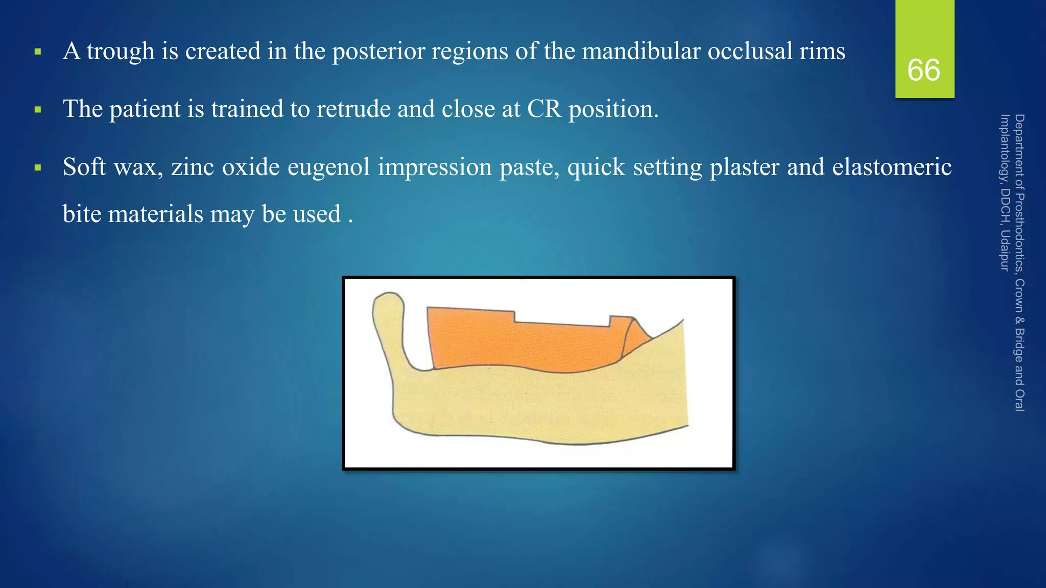  A trough is created in the posterior regions of the mandibular occlusal rims
 The patient is trained to retrude and close at CR position.
 Soft wax, zinc oxide eugenol impression paste, quick setting plaster and elastomeric
bite materials may be used .
66
 