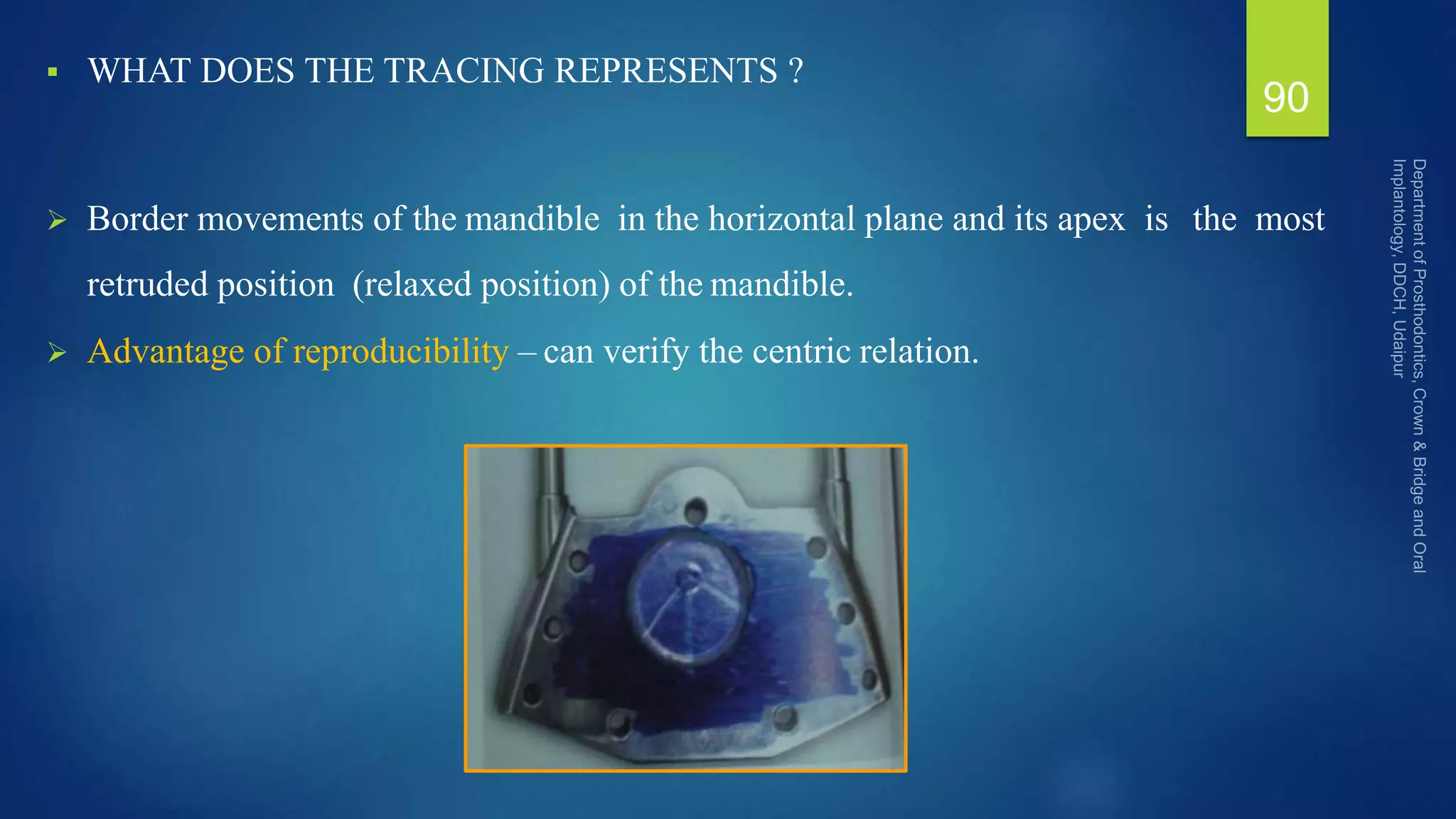  WHAT DOES THE TRACING REPRESENTS ?
 Border movements of the mandible in the horizontal plane and its apex is the most
retruded position (relaxed position) of the mandible.
 Advantage of reproducibility – can verify the centric relation.
90
 