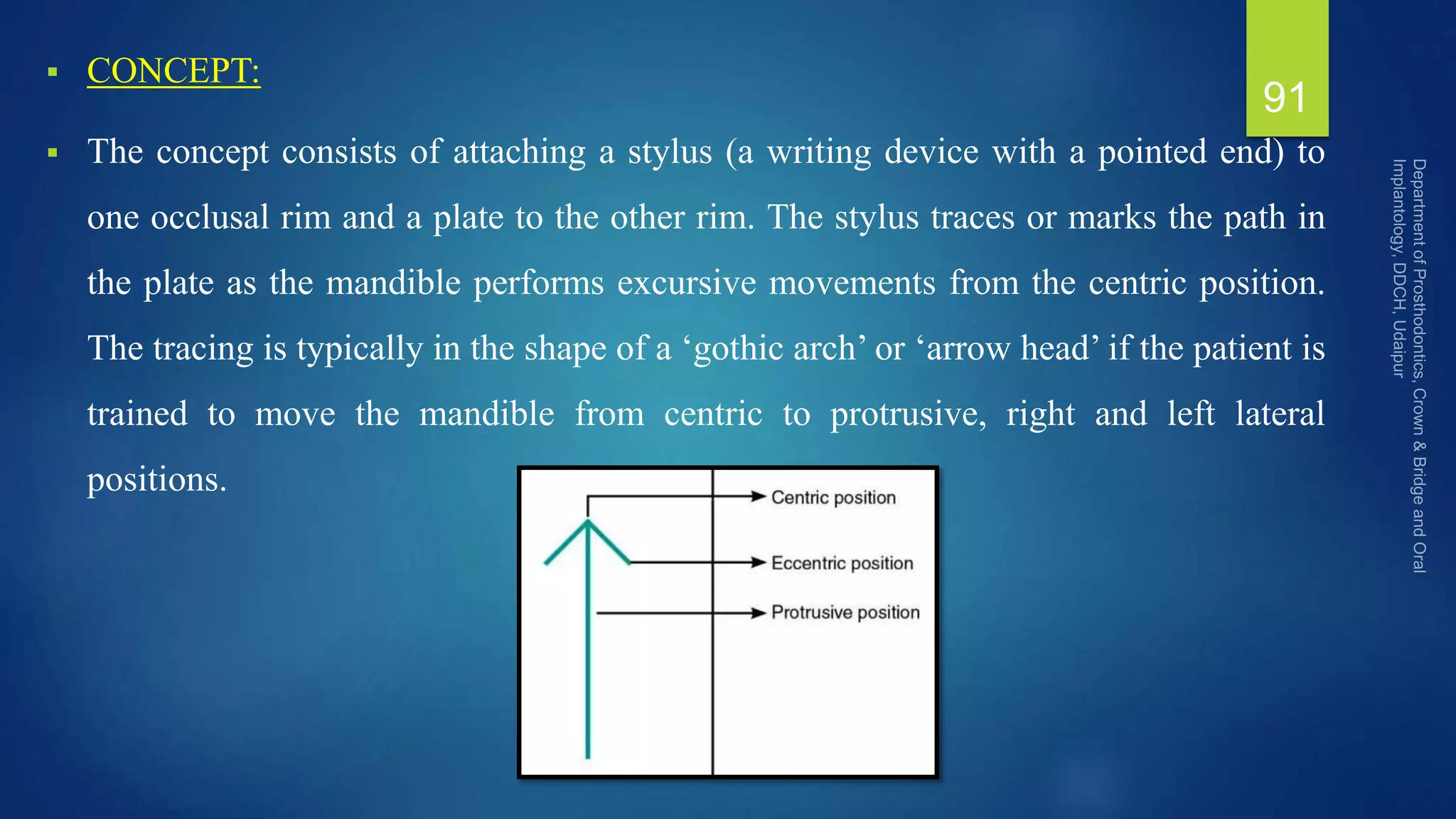  CONCEPT:
 The concept consists of attaching a stylus (a writing device with a pointed end) to
one occlusal rim and a plate to the other rim. The stylus traces or marks the path in
the plate as the mandible performs excursive movements from the centric position.
The tracing is typically in the shape of a ‘gothic arch’ or ‘arrow head’ if the patient is
trained to move the mandible from centric to protrusive, right and left lateral
positions.
91
 