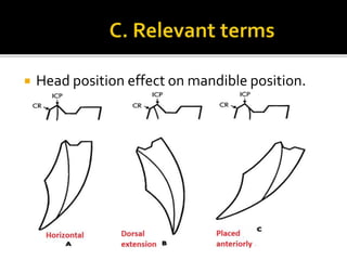  Head position effect on mandible position. 
 