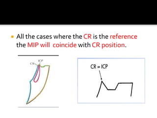  All the cases where the CR is the reference 
the MIP will coincide with CR position. 
 