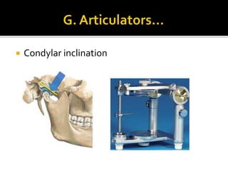  Condylar inclination 
 