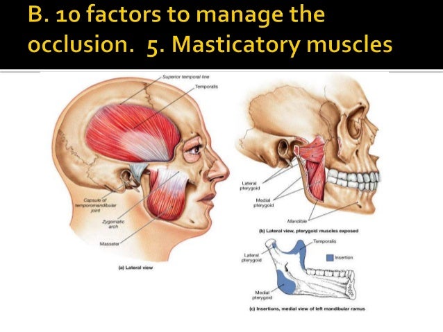 centric occlusion 15