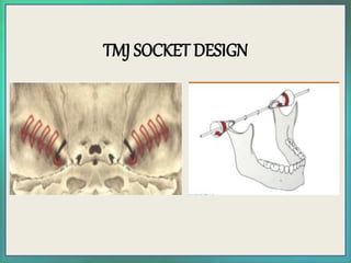 CENTRIC RELATION.pptx
