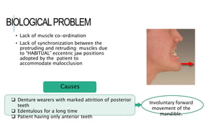 BIOLOGICALPROBLEM
 Denture wearers with marked attrition of posterior
teeth
 Edentulous for a long time
 Patient having only anterior teeth
• Lack of muscle co-ordination
• Lack of synchronization between the
protruding and retruding muscles due
to “HABITUAL” eccentric jaw positions
adopted by the patient to
accommodate malocclusion
Involuntary forward
movement of the
mandible.
Causes
 