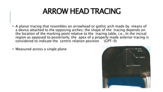 ARROW HEAD TRACING
• A planar tracing that resembles an arrowhead or gothic arch made by means of
a device attached to the opposing arches; the shape of the tracing depends on
the location of the marking point relative to the tracing table, i.e., In the incisal
region as opposed to posteriorly; the apex of a properly made anterior tracing is
considered to indicate the centric relation position (GPT-9)
• Measured across a single plane
 