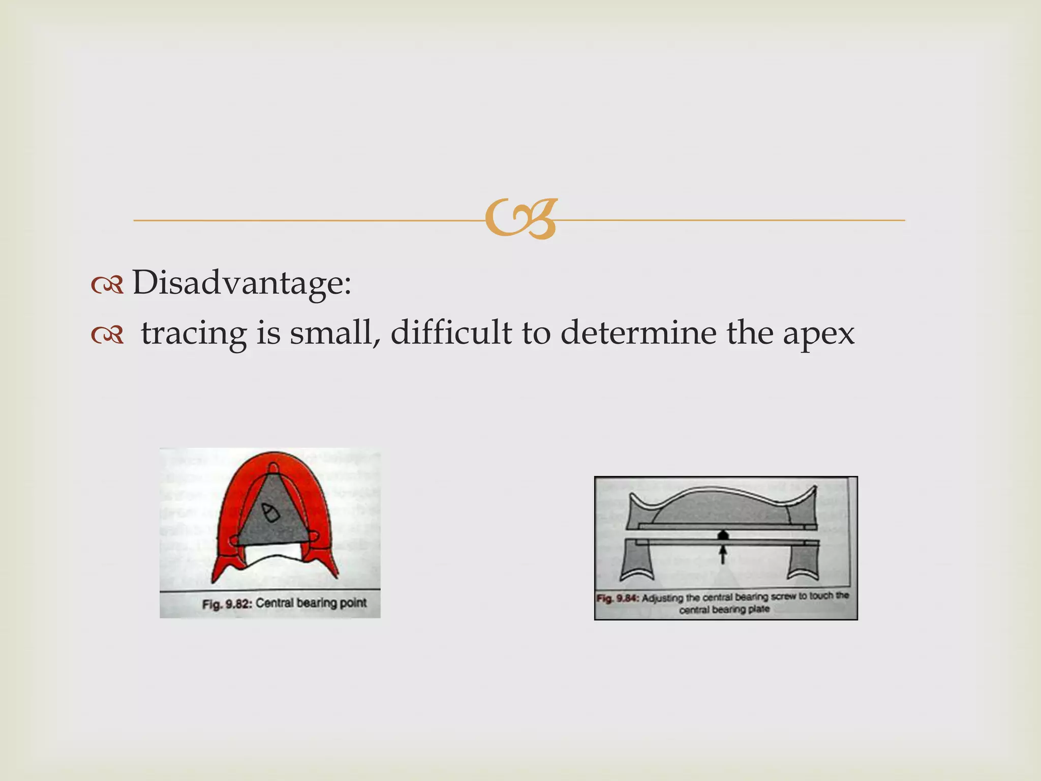 
 Disadvantage:
 tracing is small, difficult to determine the apex
 