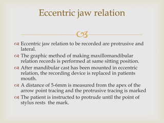 Eccentric jaw relation

                           
 Eccentric jaw relation to be recorded are protrusive and
  lateral.
 The graphic method of making maxillomandibular
  relation records is performed at same sitting position.
 After mandibular cast has been mounted in eccentric
  relation, the recording device is replaced in patients
  mouth.
 A distance of 5-6mm is measured from the apex of the
  arrow point tracing and the protrusive tracing is marked
 The patient is instructed to protrude until the point of
  stylus rests the mark.
 
