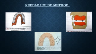 NEEDLE HOUSE METHOD.
 