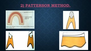2) PATTERSON METHOD.
 