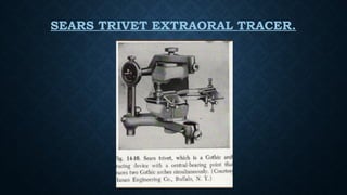 SEARS TRIVET EXTRAORAL TRACER.
 