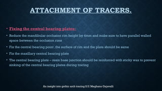 ATTACHMENT OF TRACERS.
• Fixing the central bearing plates:
• Reduce the mandibular occlusion rim height by 4mm and make sure to have parallel walled
space between the occlusion rims
• Fix the central bearing point ,the surface of rim and the plate should be same
• Fix the maxillary central bearing plate
• The central bearing plate – resin base junction should be reinforced with sticky wax to prevent
sinking of the central bearing plates during tracing
An insight into gothic arch tracing S.U. Meghana Gajavalli
 