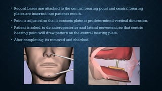 • Record bases are attached to the central bearing point and central bearing
plates are inserted into patient's mouth.
• Point is adjusted so that it contacts plate at predetermined vertical dimension.
• Patient is asked to do anteroposterior and lateral movement, so that centric
bearing point will draw pattern on the central bearing plate.
• After completing, its removed and checked.
 