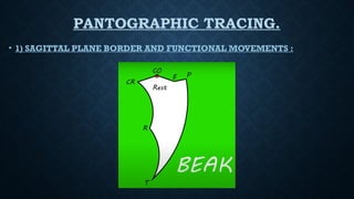 PANTOGRAPHIC TRACING.
• 1) SAGITTAL PLANE BORDER AND FUNCTIONAL MOVEMENTS :
 