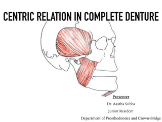 FIGURE 7-3 Edentulous mandible in centric relation.
CENTRIC RELATION IN COMPLETE DENTURE
Presenter
Dr. Aastha Subba
Junior Resident
Department of Prosthodontics and Crown-Bridge
 