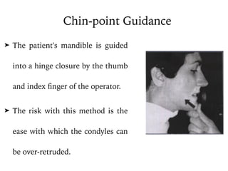 ➤ The patient's mandible is guided
into a hinge closure by the thumb
and index finger of the operator.
➤ The risk with this method is the
ease with which the condyles can
be over-retruded.
Chin-point Guidance
 