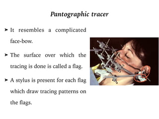 ➤ It resembles a complicated
face-bow.
➤ The surface over which the
tracing is done is called a flag.
➤ A stylus is present for each flag
which draw tracing patterns on
the flags.
Pantographic tracer
62 PART I Planning and Preparation
FIGURE 2-34 ■ The Stuart instrument, used to make pantographic
recordings. (Courtesy Drs. R. Giering and J. Petrie.)
W
Pantographic Recordings. Fully adjustable articula-
tors are usually programmed on the basis of a panto-
graphic recording (Fig. 2-34). Jaw movements are
registered by directional tracings on recording plates.
The plates are rigidly attached to one jaw, and the record-
ing styli are attached to the other. A total of six plates are
needed to achieve a precise movement record of the man-
 