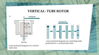 VERTICAL- TUBE ROTOR
cross-sectional diagram of a vertical
tube rotor
cross-sectional diagram of a centrifuge tube
positioned in a vertical tube rotor
 