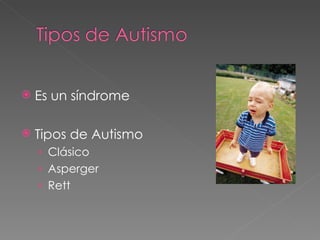 Es un síndrome Tipos de Autismo Clásico Asperger Rett