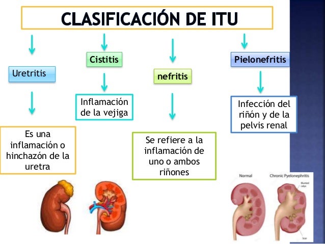 Que es el itu Que es el itu