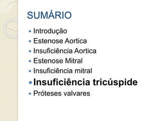 SUMÁRIO
 Introdução
 Estenose Aortica
 Insuficiência Aortica
 Estenose Mitral
 Insuficiência mitral
Insuficiência tricúspide
 Próteses valvares
 