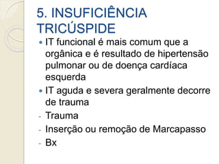 5. INSUFICIÊNCIA
TRICÚSPIDE
 IT funcional é mais comum que a
orgânica e é resultado de hipertensão
pulmonar ou de doença cardíaca
esquerda
 IT aguda e severa geralmente decorre
de trauma
- Trauma
- Inserção ou remoção de Marcapasso
- Bx
 