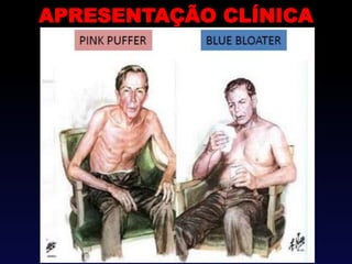 APRESENTAÇÃO CLÍNICA
 