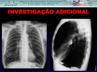 INVESTIGAÇÃO ADICIONAL
 