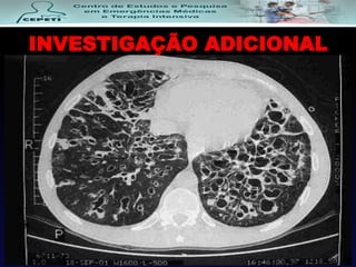 INVESTIGAÇÃO ADICIONAL
 