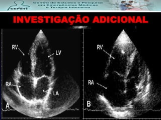 INVESTIGAÇÃO ADICIONAL
 