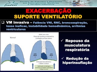 EXACERBAÇÃO
SUPORTE VENTILATÓRIO
 VM invasiva – Falência VNI, RNC, broncoaspiração,
tosse ineficaz, instabilidade hemodinâmica, arritmias
ventriculares
 Repouso da
musculatura
respiratória
 Redução da
hiperinsuflação
 