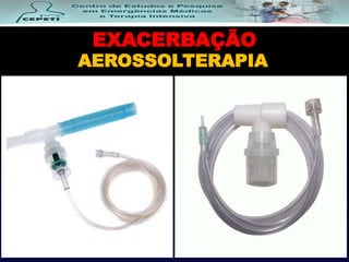 EXACERBAÇÃO
AEROSSOLTERAPIA
 