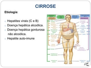 CIRROSE
Etiologia:
o Hepatites virais (C e B)
o Doença hepática alcoólica.
o Doença hepática gordurosa
não alcoólica.
o He...