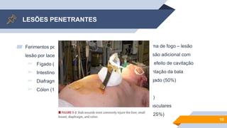LESÕES PENETRANTES
▰ Ferimentos por arma branca –
lesão por laceração
▻ Fígado (40%)
▻ Intestino delgado (30%)
▻ Diafragma (20%)
▻ Cólon (15%)
▰ Ferimentos por arma de fogo – lesão
por laceração + lesão adicional com
base na trajetória, efeito de cavitação
e possível fragmentação da bala
▻ Intestino delgado (50%)
▻ Cólon (40%)
▻ Fígado (30%)
▻ Estruturas vasculares
abdominais (25%)
10
 