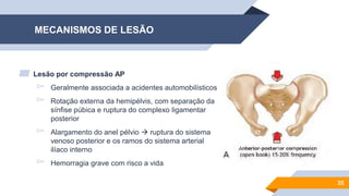 MECANISMOS DE LESÃO
▰ Lesão por compressão AP
▻ Geralmente associada a acidentes automobilísticos
▻ Rotação externa da hemipélvis, com separação da
sínfise púbica e ruptura do complexo ligamentar
posterior
▻ Alargamento do anel pélvio  ruptura do sistema
venoso posterior e os ramos do sistema arterial
ilíaco interno
▻ Hemorragia grave com risco a vida
35
 