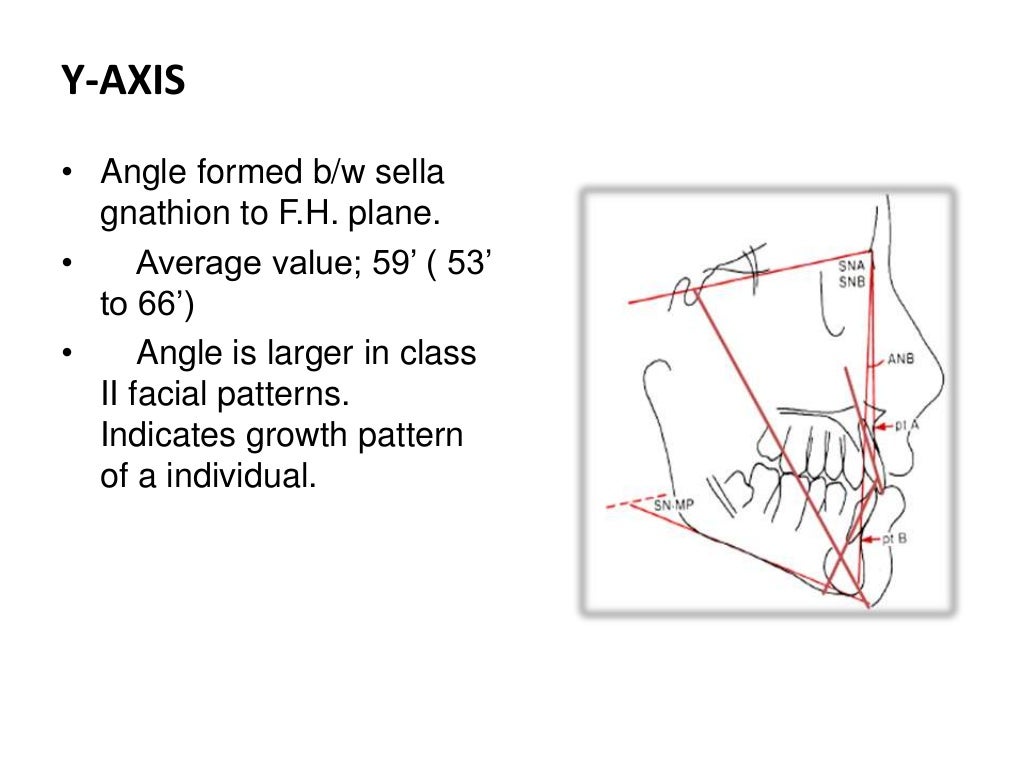 Cephalometric Analysis