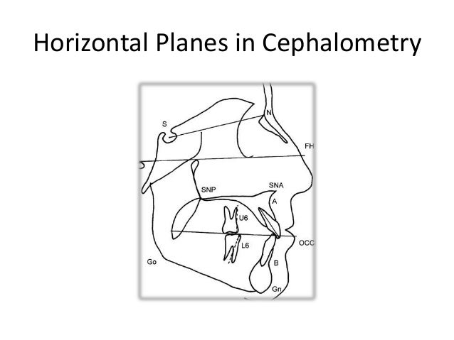 cephalometric analysis cephalometric analysis