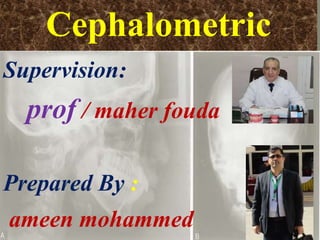 Cephalometric
Supervision:
prof / maher fouda
Prepared By :
ameen mohammed
 