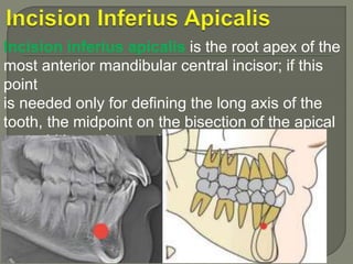 Cephalometic | PPTX