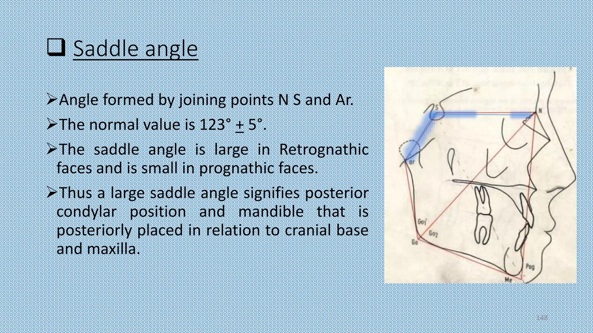  Saddle angle
Angle formed by joining points N S and Ar.
The normal value is 123° + 5°.
The saddle angle is large in Retrognathic
faces and is small in prognathic faces.
Thus a large saddle angle signifies posterior
condylar position and mandible that is
posteriorly placed in relation to cranial base
and maxilla.
148
 