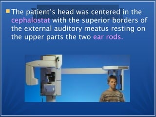  The patient’s head was centered in the
cephalostat with the superior borders of
the external auditory meatus resting on
the upper parts the two ear rods.
 