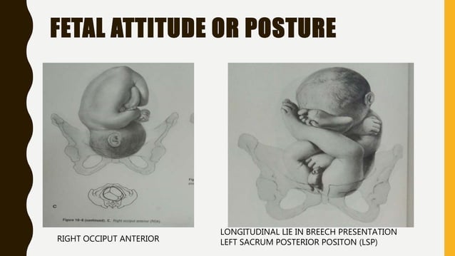 why presentation is cephalic