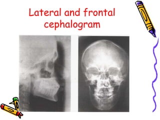 Cephalometic Radiography O.ppt