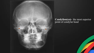 Condylion(co)- the most superior
point of condylar head
 