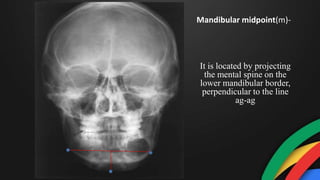 It is located by projecting
the mental spine on the
lower mandibular border,
perpendicular to the line
ag-ag
Mandibular midpoint(m)-
 