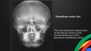 The most prominent lateral point
on the buccal surface of the
second deciduous or first
permanent mandibular molar
Mandibular molar (lm)
 