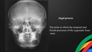 Jugal process
The point at which the temporal and
frontal processes of the zygomatic bone
meet
 