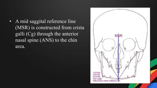 • A mid saggital reference line
(MSR) is constructed from crista
galli (Cg) through the anterior
nasal spine (ANS) to the chin
area.
 