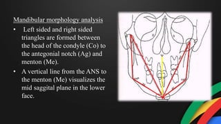 Mandibular morphology analysis
• Left sided and right sided
triangles are formed between
the head of the condyle (Co) to
the antegonial notch (Ag) and
menton (Me).
• A vertical line from the ANS to
the menton (Me) visualizes the
mid saggital plane in the lower
face.
 
