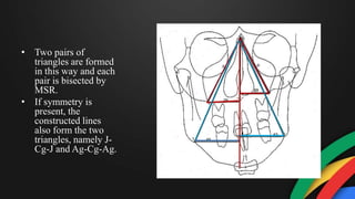 • Two pairs of
triangles are formed
in this way and each
pair is bisected by
MSR.
• If symmetry is
present, the
constructed lines
also form the two
triangles, namely J-
Cg-J and Ag-Cg-Ag.
 